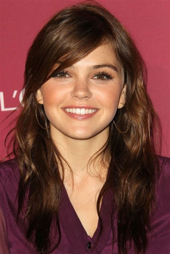 Aimee Teegarden Plastic Surgery and Weight Loss Details