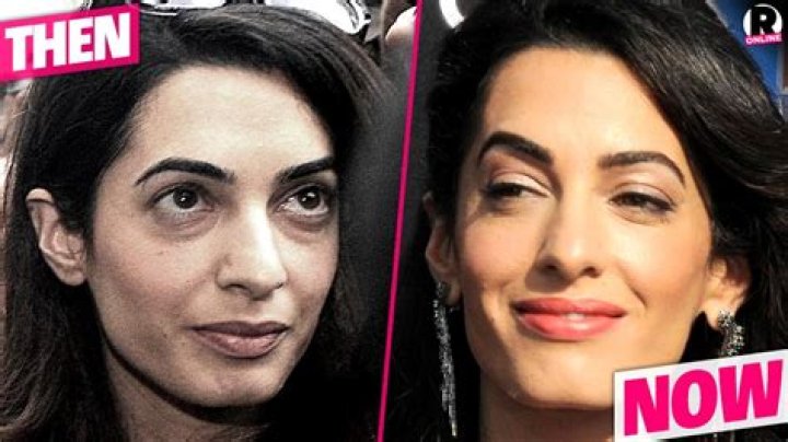 Amal Clooney Before Plastic Surgery: A Deep Dive Into Her Transformation