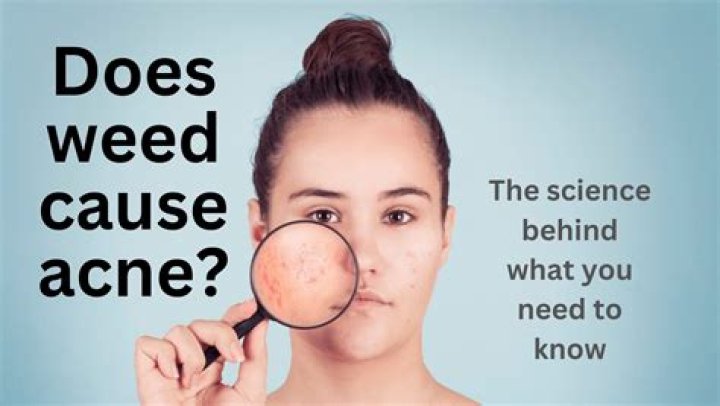 Can Smoking Weed Wreck Your Skin?