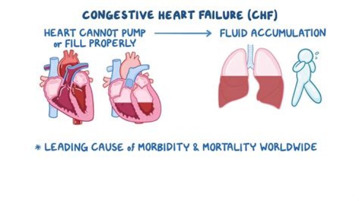 CNN - Wynette autopsy finds heart failure cause of death
