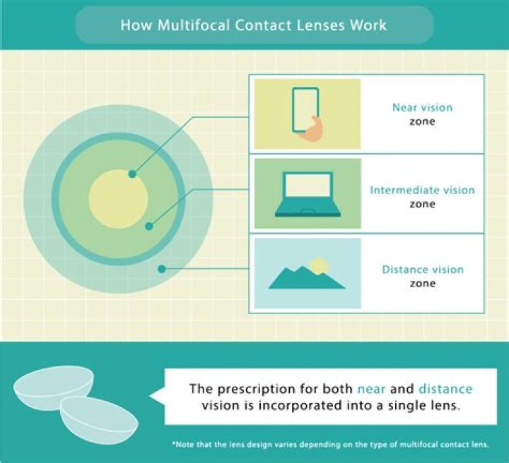 Contact Lenses that Improve Sports Performance