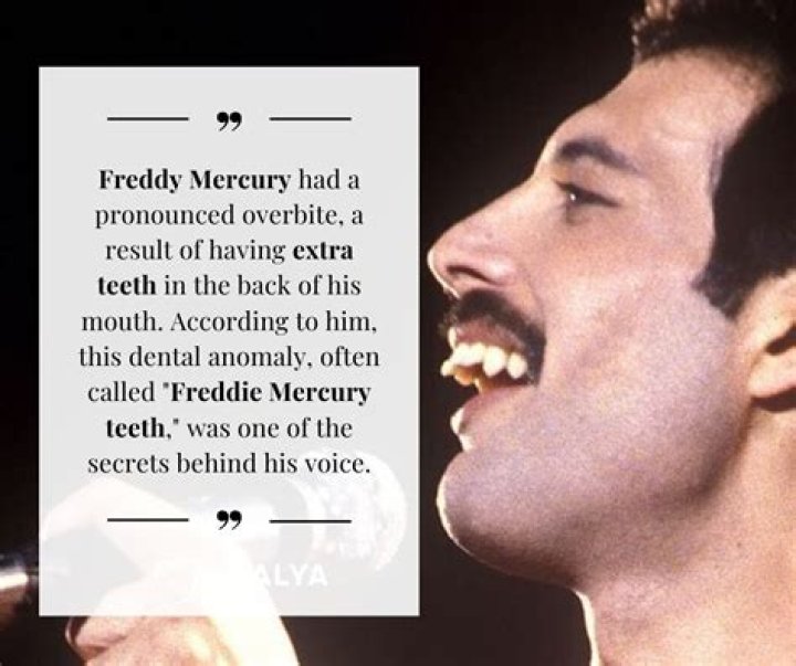 Did Freddie Mercury Have Any Children? A Deep Dive Into The Life Of The Legendary Queen Frontman