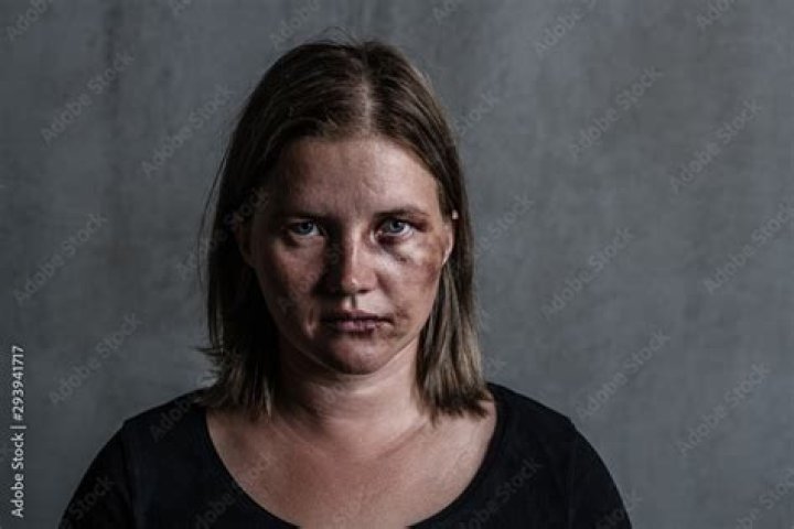 Domestic Violence: Just As Bad When A Woman Hits A Man?