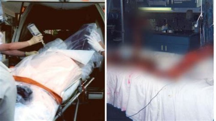 Exploring Hisashi Ouchi's Skin Pictures: A Deep Dive Into A Tragic Case
