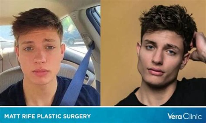 Exploring the Relationship Between Matt Rife and Brandon Wardell: Unraveling What Happened