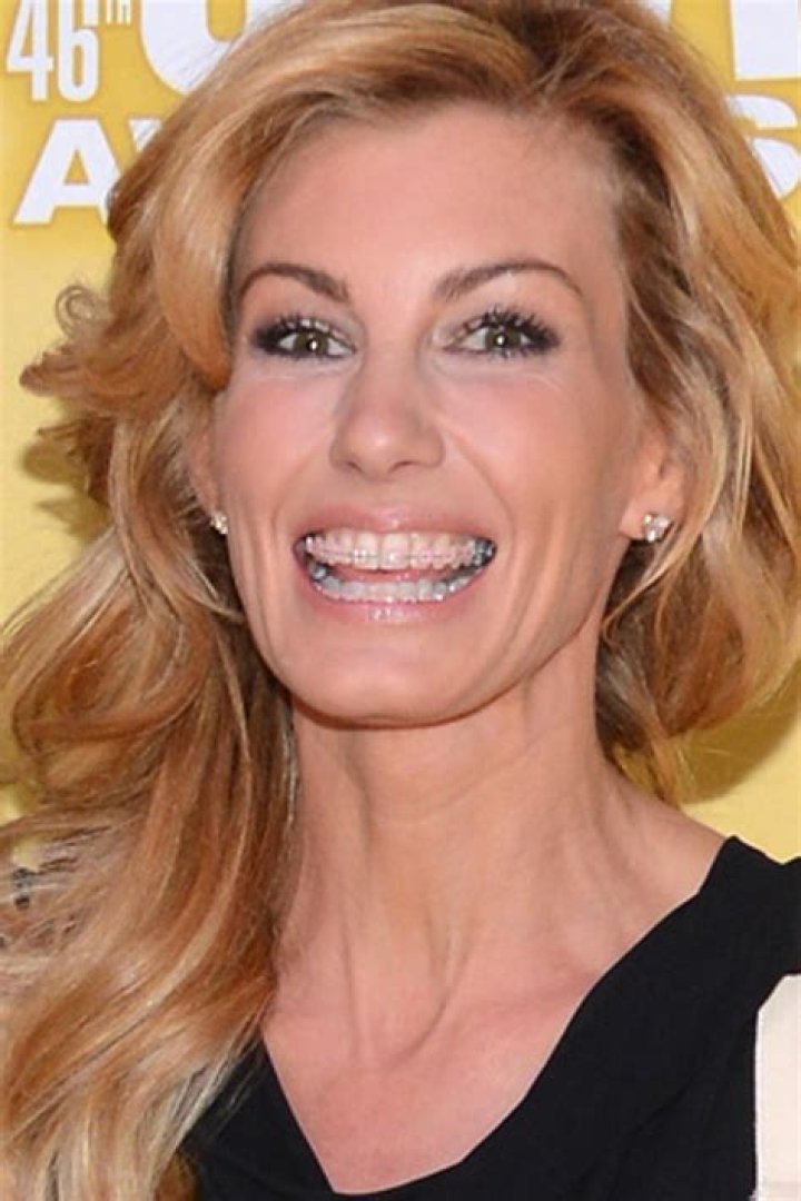 Faith Hill Gets Braces