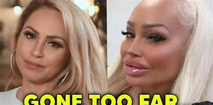  Fans think Darcey Silva’s numb-looking lips need some serious TLC Mon 14 February 2022 16:40 Celine Byford 