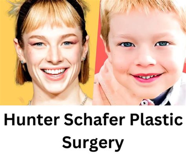 Has Hunter Schafer Had Surgery? A Comprehensive Look At Her Journey