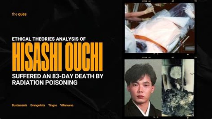 Hisashi Ouchi Autopsy Report: An In-Depth Analysis Of A Tragic Incident