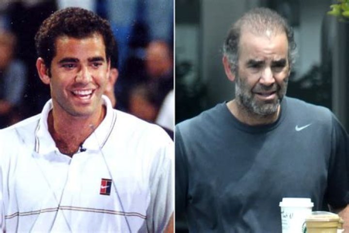 How Old Was Pete Sampras When He Retired? A Comprehensive Look Into His Career And Legacy