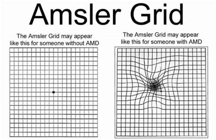 How To Use The Amsler Grid