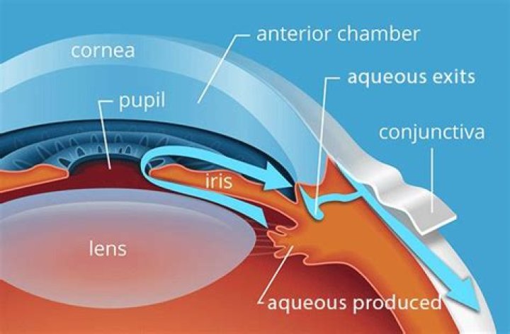 Hypotony: Low Eye Pressure