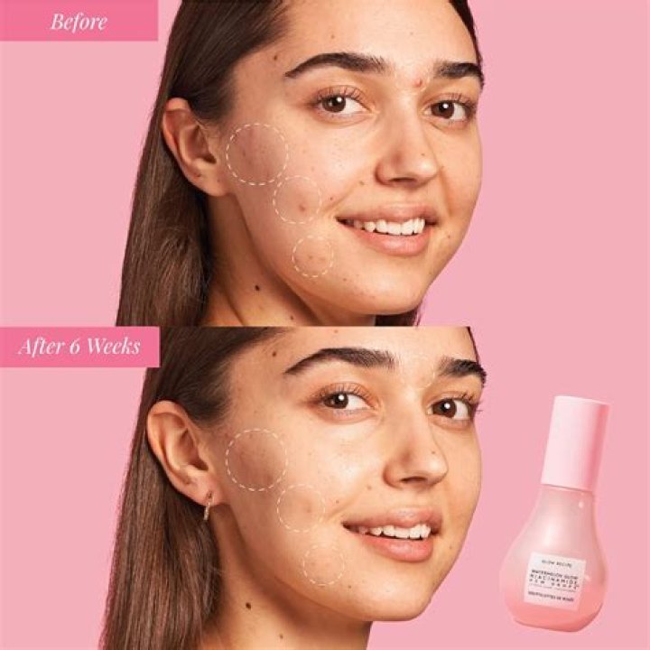 I Don't Need Highlighter With Glow Recipe's Dew Drops Serum
