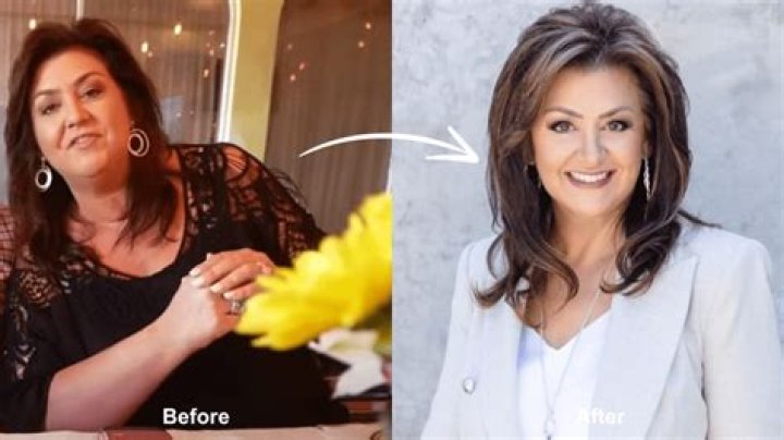 Joni Lamb: Her Journey Before Weight Loss Surgery