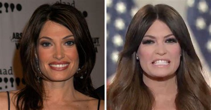 Kimberly Guilfoyle Plastic Surgery 2024: Transformations And Impact