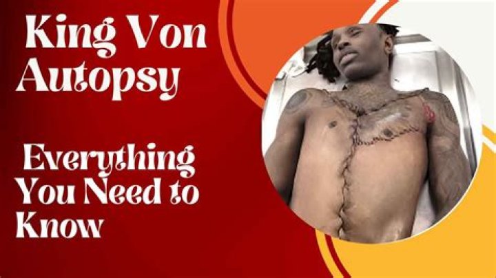 King Von's Autopsy: A Deep Dive Into The Life And Legacy Of A Fallen Star