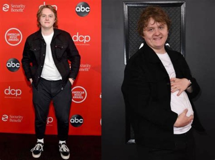 Lewis Capaldi Weight Loss: Journey To Health And Transformation