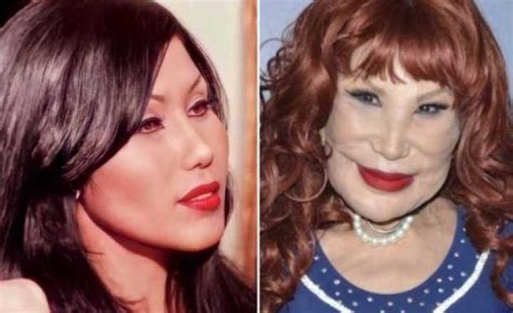 Lyn May Surgery: The Journey To Recovery And Transformation