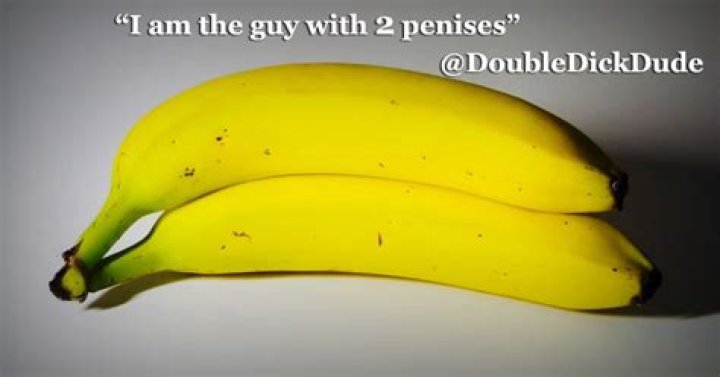 Meet The Man With TWO Fully-Functioning Penises