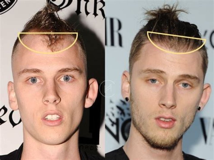 MGK Age In 2024: A Comprehensive Look At Machine Gun Kelly's Journey Through The Years