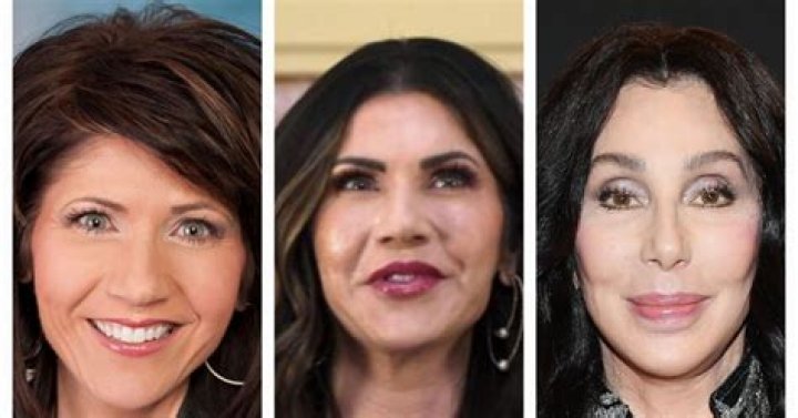 Noem Plastic Surgery: Everything You Need To Know