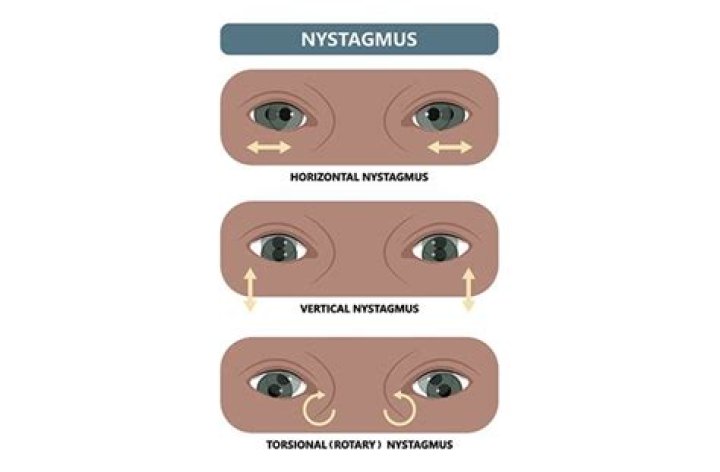 Nystagmus in Field Sobriety Testing