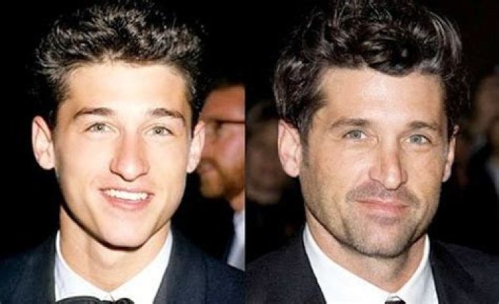 Patrick Dempsey Rhinoplasty: A Comprehensive Look At His Transformation
