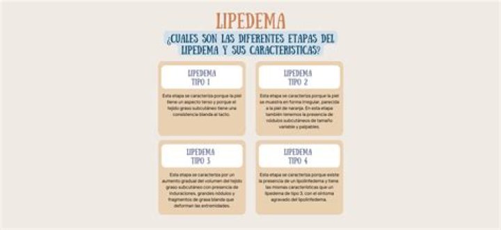 ¿Qué es el lipedema y cuál es su tratamiento?