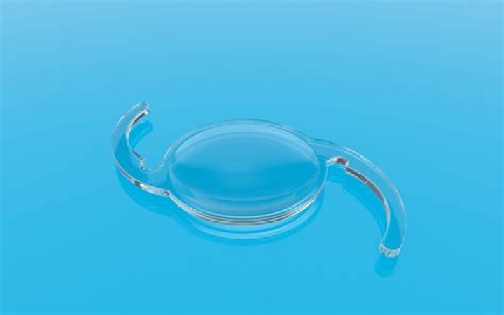Refractive Lens Exchange or Lens Replacement Surgery