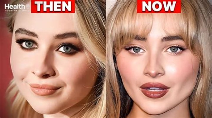 Sabrina Carpenter Surgery: What You Need To Know