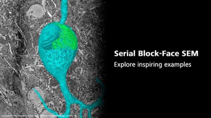 Serial Block Face Imaging - Electron Microscopy Research Services