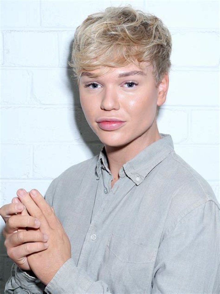 The Truth About Jack Vidgen's Plastic Surgery and Lips Fillers