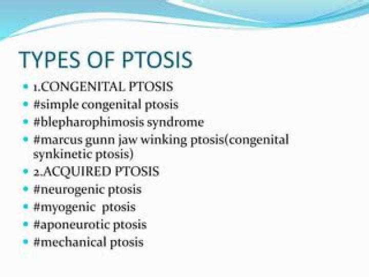 Types of Ptosis