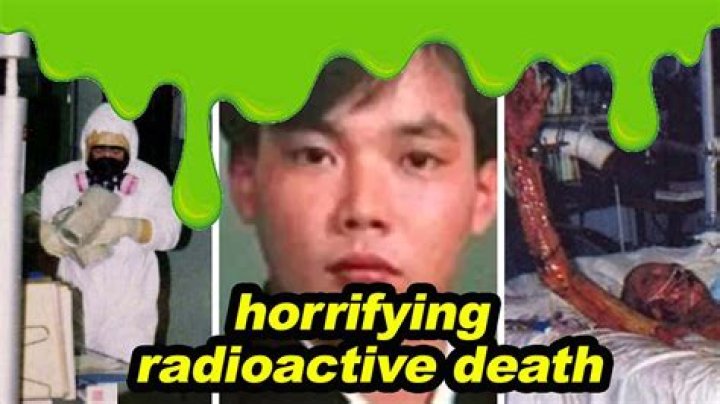 Understanding Hisashi Ouchi Injuries: A Deep Dive Into The Tragedy