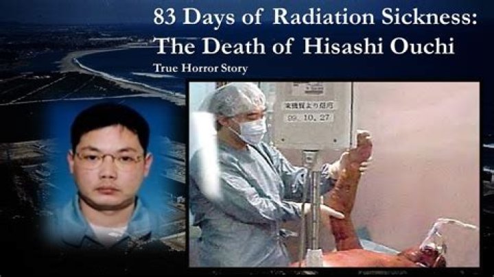 Understanding Hisashi Ouchi: The Tragic Case And Its Impact On Radiation Safety