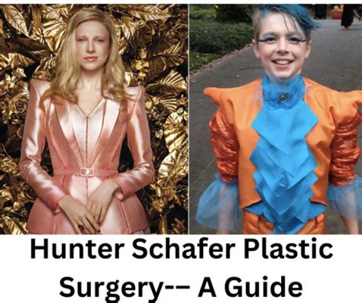 Understanding Hunter Schafer Surgery: Insights And Implications