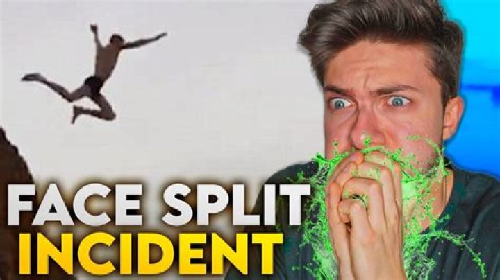 Unraveling The Face Split Diving Incident Video: A Cautionary Tale
