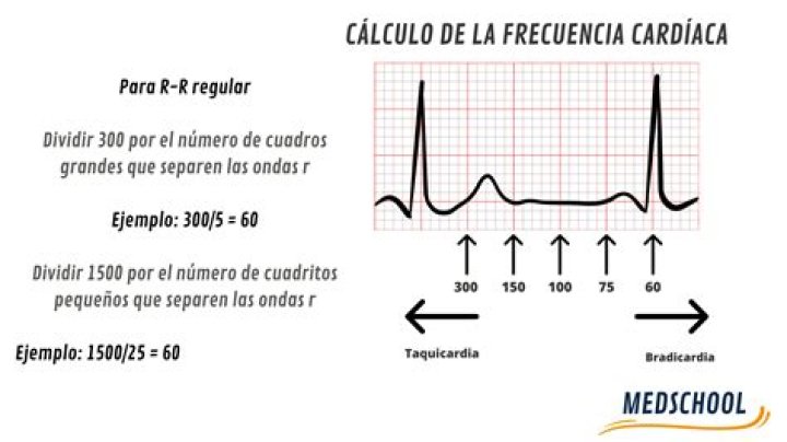 Variabilidad de la Frecuencia Cardíaca : Gráfico, Rango, Sueño