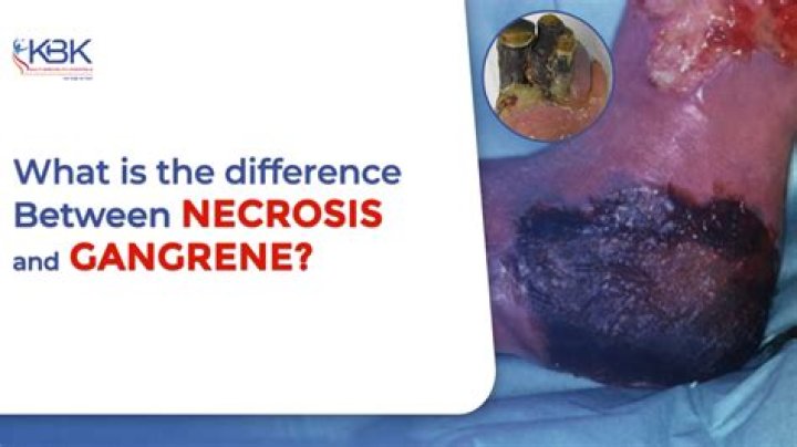 What is the difference between necrosis and gangrene?