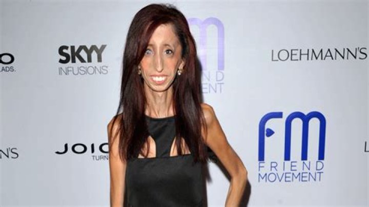 Who is Lizzie Velasquez dating? Lizzie Velasquez boyfriend, husband