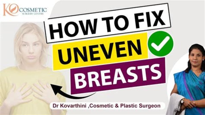 Why Do I Have Uneven Breasts? 5 Things To Know If You're Boobs Are Asymmetrical