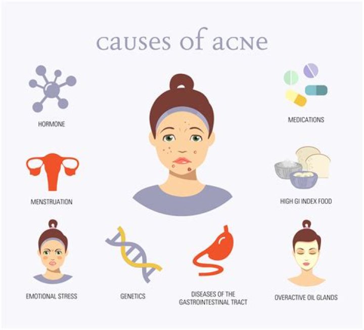 Why Stress can Cause Acne and How to Treat Breakouts