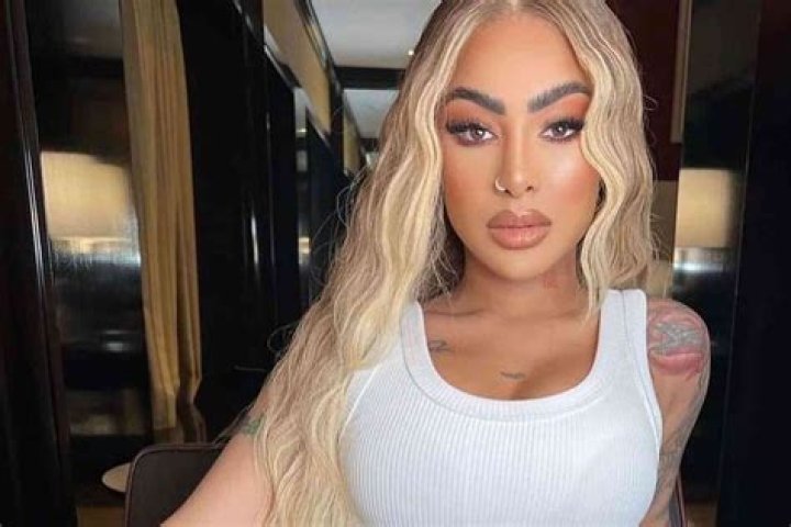 Yailin La Más Viral Injury: What Really Happened?